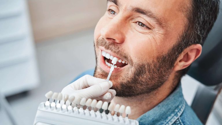 branqueamentos dentários