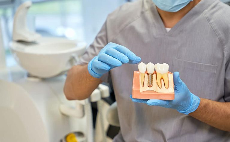 Técnicas de Carga Imediata – O Presente dos Implantes Dentários