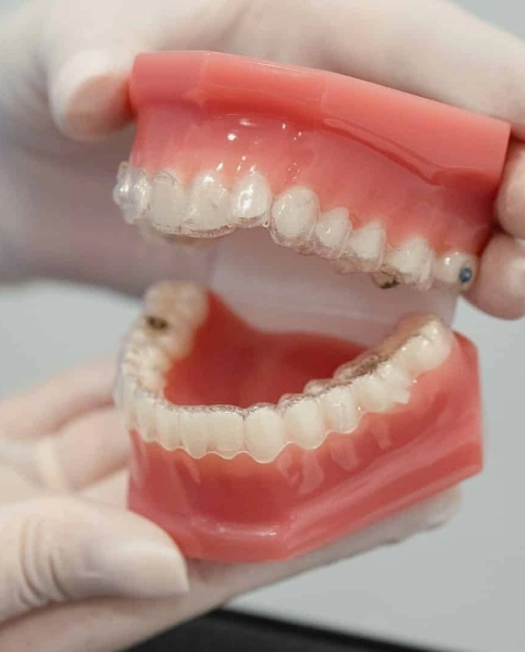 Tratamento Invisalign em Oeiras na Clínica Dr. Pedro Coelho