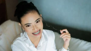 sorriso com aparelhos