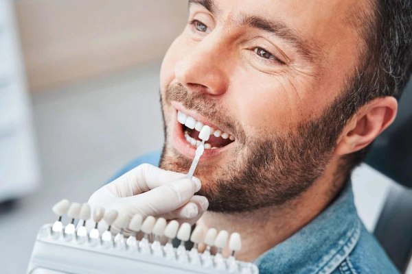 avaliação de cor para branqueamento dentário na clínica dr pedro coelho em oeiras