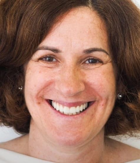 Paciente satisfeito após carga imediata em implantologia oral