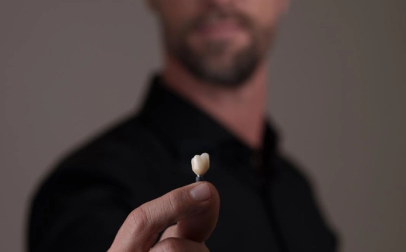 Implante dentário para substituir um dente perdido